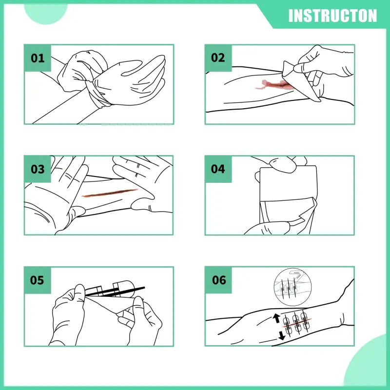 Kit de Soin Pour Plaies - Kit de fermeture de plaie